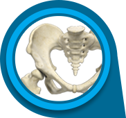 Hip Dysplasia