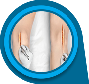 Minimally Invasive Knee Joint Replacement